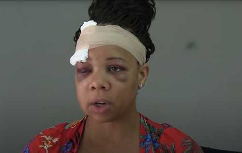 'He’s a Good Guy': Police Sergeant Barred from Investigating Citizen Complaints After Favoring Officer Who Shot a Woman In the Face with a Rubber Bullet