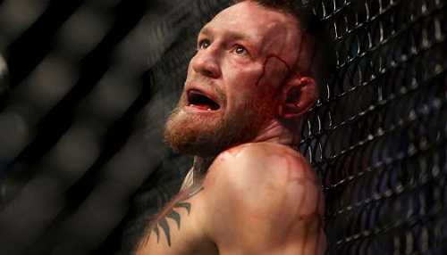 Conor McGregor Suffers Gruesome Leg Injury In 1st Round TKO Loss To Dustin Poirier, Still Talks Smack After Taking L
