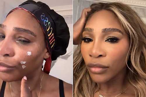Serena Williams Faces Skin-Bleaching Allegations: Fans React to Viral Video.