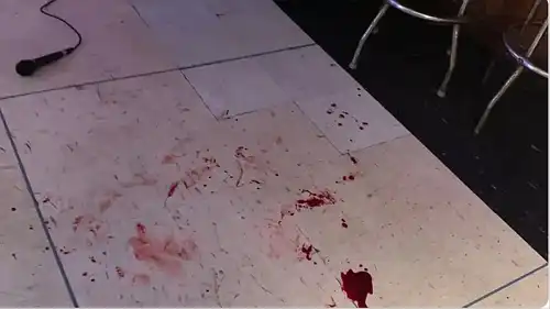 'I Think They Wanted to Kill': Several People Injured After Racist Slur Leads to All-Out Bar Brawl In Atlanta 'I Think They Wanted to Kill': Several People Injured After Racist Slur Leads to All-Out Bar Brawl In Atlanta