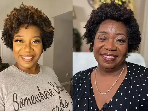 Veteran teacher blinded in one eye by student forgives her attacker - Face2Face Africa