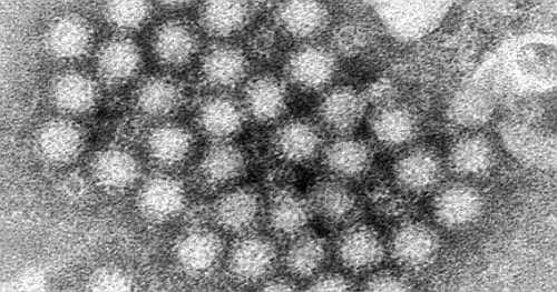 Norovirus cases are surging in parts of the U.S. this winter, CDC data show