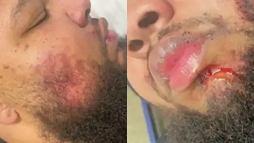 Outrage Erupts After Black Man Beaten by Multiple Cops Leaves with No Charges, As More Shocking Videos of Abuse Against Black Citizens Surface Outrage Erupts After Black Man Beaten by Multiple Cops Leaves with No Charges, As More Shocking Videos of Abuse Against Black Citizens Surface