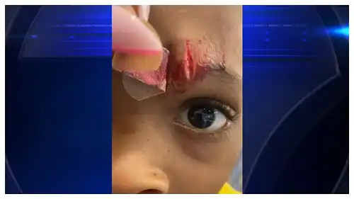 'She Should be In Prison!': Outrage As Florida Teacher Who Allegedly Slashed 5-Year-Old's Face with Ruler Is Allowed to Teach While Child Abuse Case Is Pending