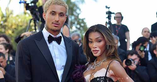 Winnie Harlow and Kyle Kuzma Are Engaged