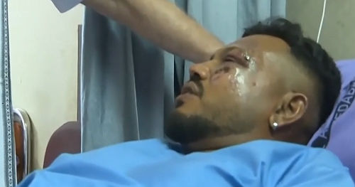 What we know about the lone survivor in deadly Air India plane crash
