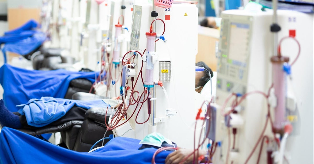 Does the kidney dialysis industry cut corners when it comes to meeting federal standards?