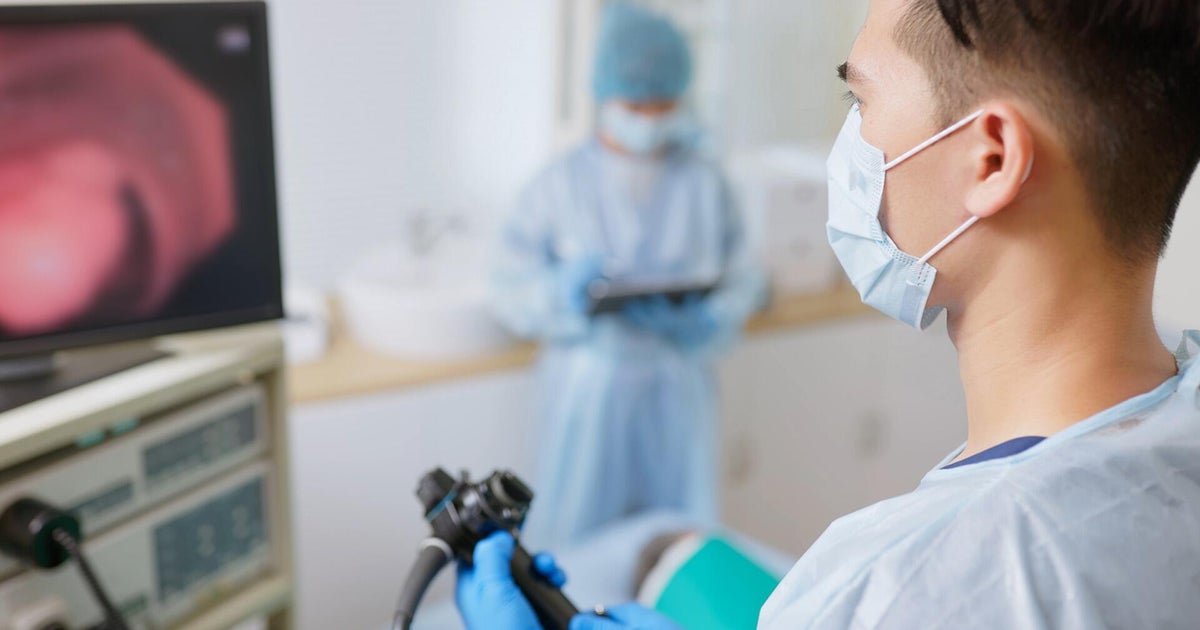 Colon cancer cases nearly doubled in 4 years among Americans 45-49, study finds