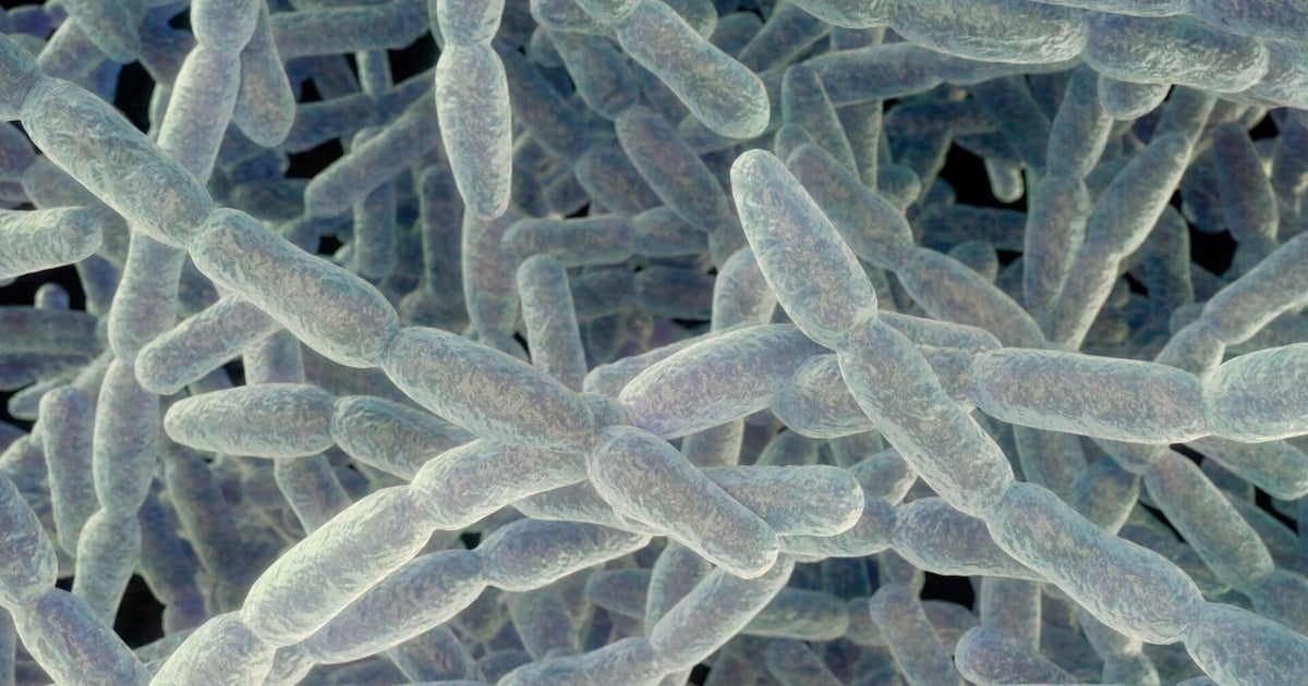 What to know about Legionnaires