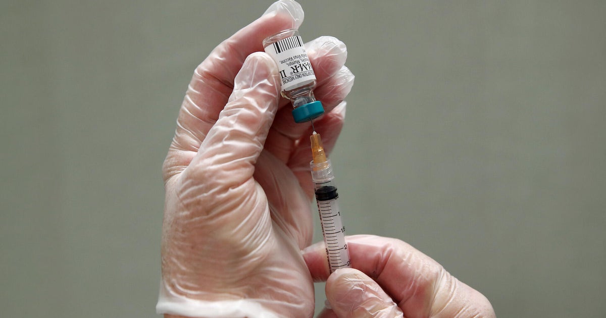 South Carolina measles outbreak is now larger than Texas 2025 outbreak, new data shows