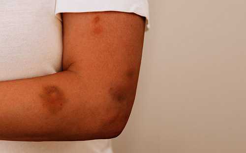 How ICE Is Making It Harder For Immigrants To Escape Domestic Violence