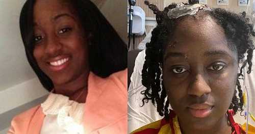 Black Woman Says Birth Control Shots Gave Her a Brain Tumor