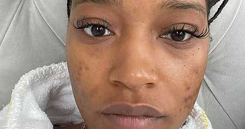 Keke Palmer Says Her Childhood Was the “Darkest” Time of Her Life and That Fame Traumatized Her