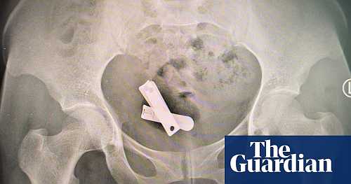 Rusted screws, metal spikes and plastic rubbish: the horrific sexual violence used against Tigray’s women