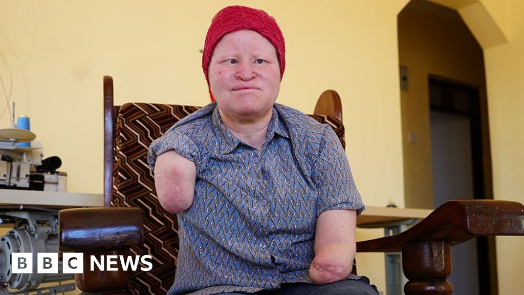 Tanzania election: The fears that voting time brings for those with albinism