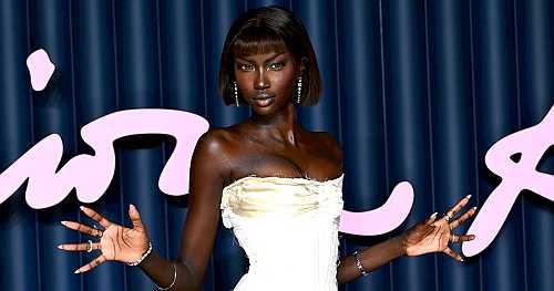 Supermodel Anok Yai Opens Up About Being Diagnosed With a Congenital Defect