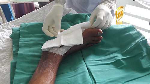 Live maggot therapy prove better than surgery for cuts