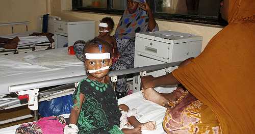  Somali families devastated as child hunger worsens amid aid cuts | Africanews