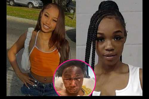 Teen Gets 3 Years In Prison for Throwing Acid on 17-Year-Old Girl During Fight - Y